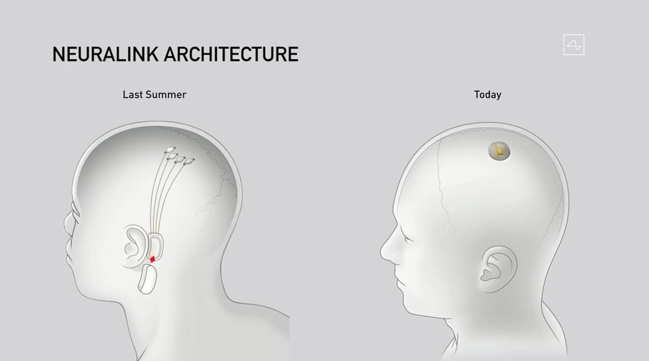 Neuralink Press Image