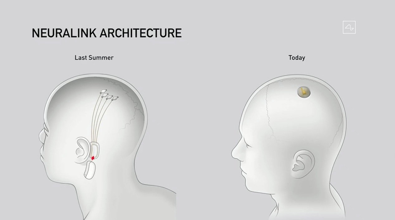 Why the Neuralink pig demo was a big deal